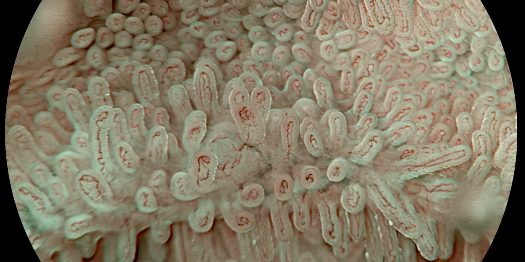 Увеличительная эндоскопия: когда врач видит то, что раньше было невидимым