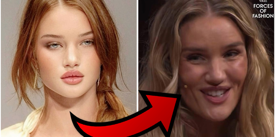 Из красавицы в чудовище: что происходит с лицом Рози Хантингтон-Уайтли