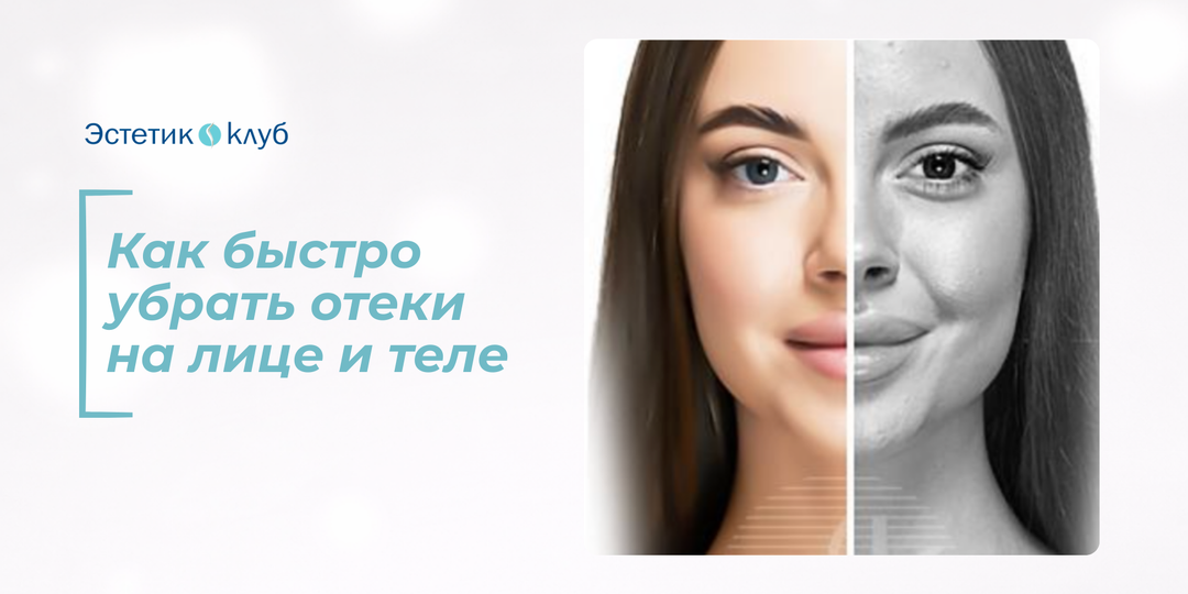 Как быстро убрать отеки на лице и теле: домашние способы и процедуры