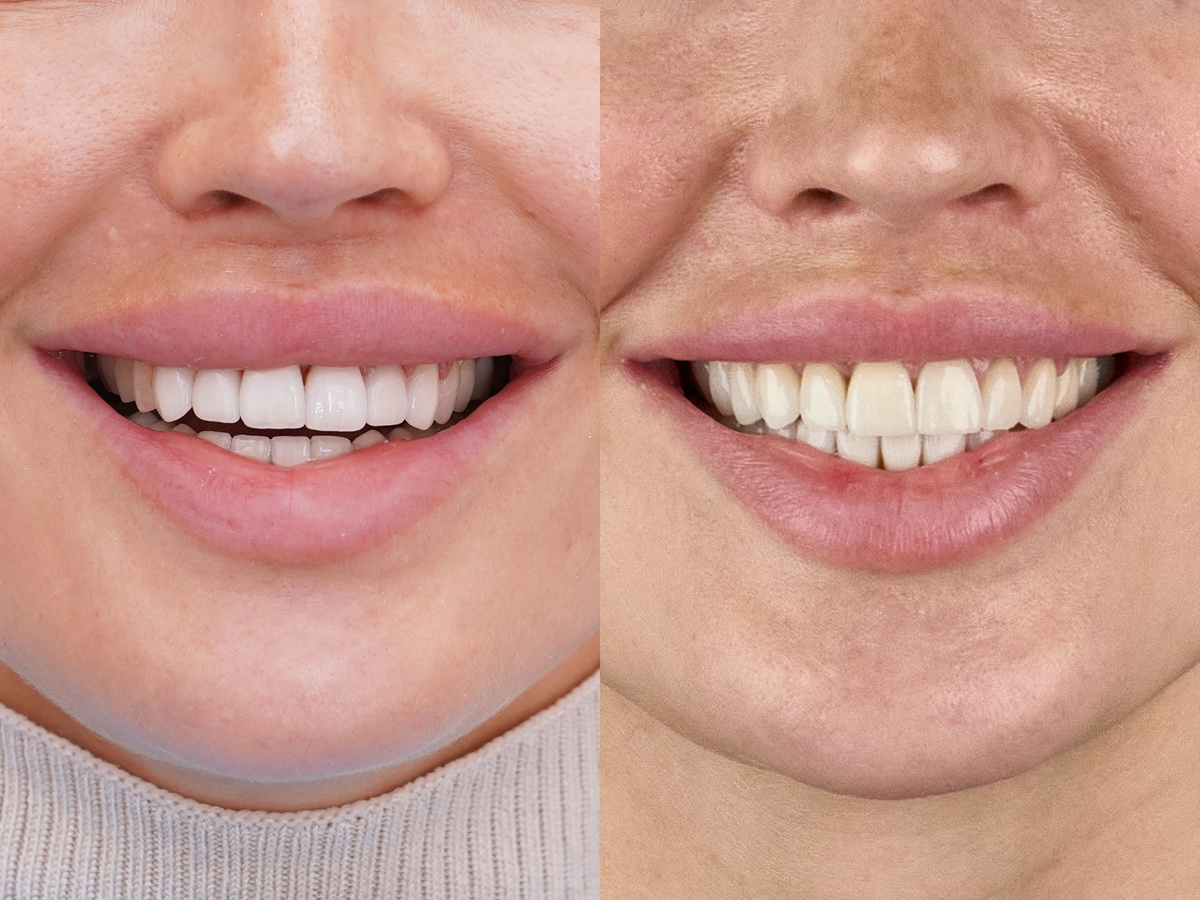 Работа на этапе примерки