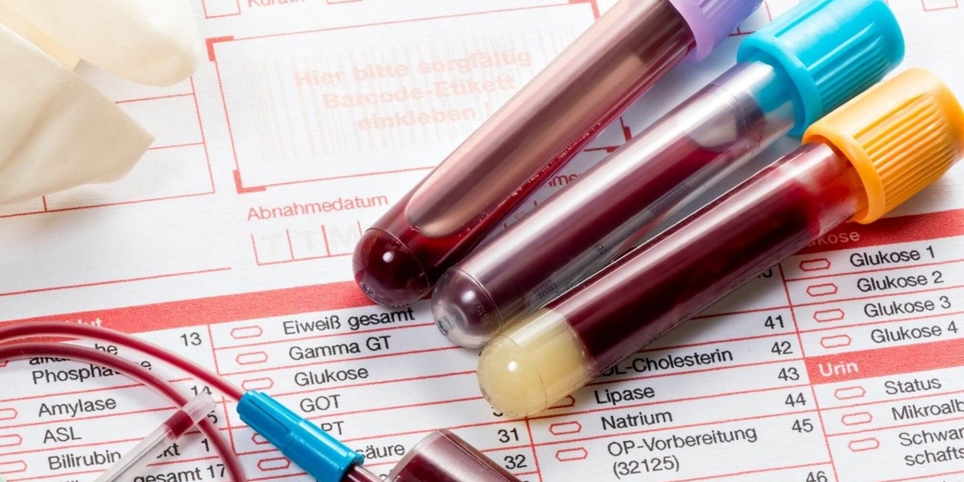 Что на самом деле означают лейкоциты в анализах крови и почему они так важны