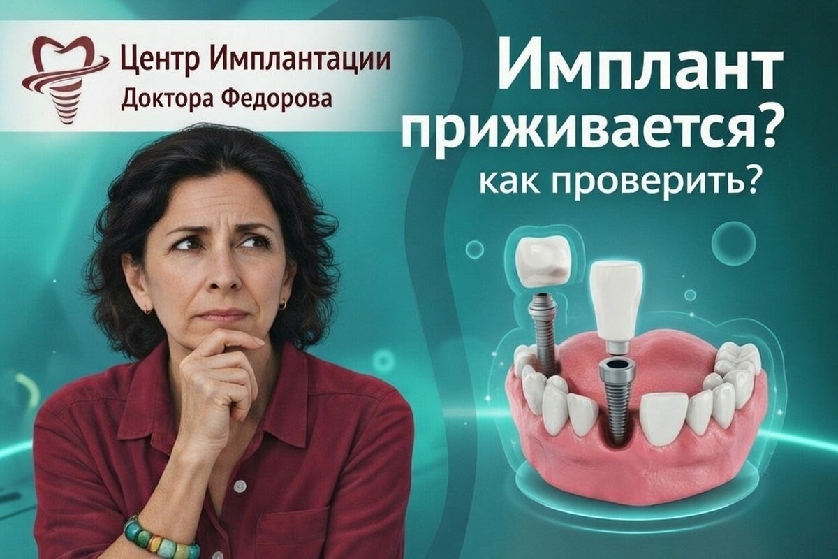 После установки зубных имплантов многие начинают пережевать приживутся ли они. 