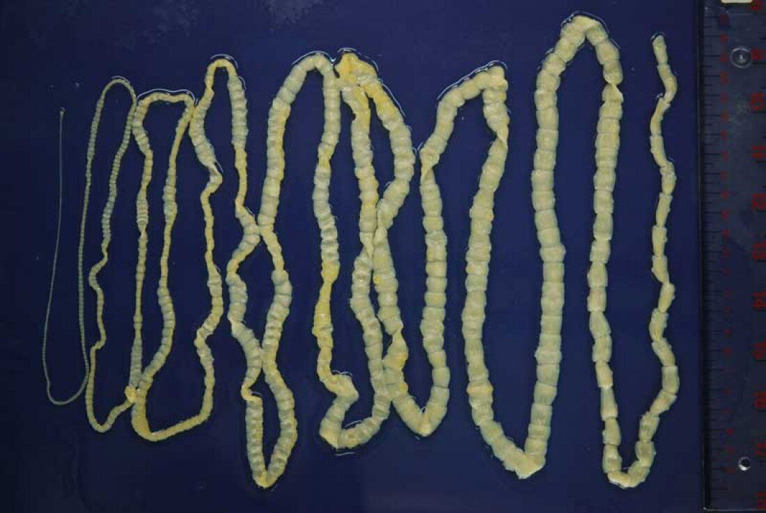 Бычий цепень. Яндекс картинки