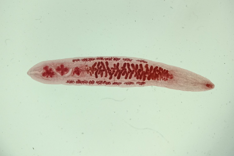 Описторхис. Яндекс картинки