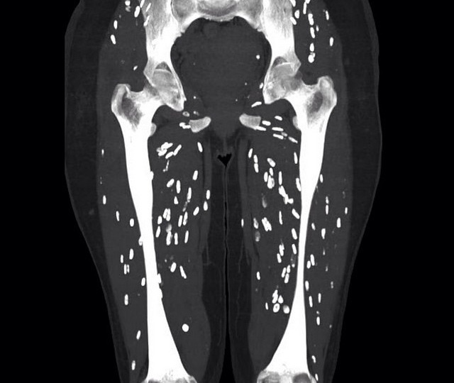 Каких паразитов можно заработать, если употреблять сырое мясо или рыбу