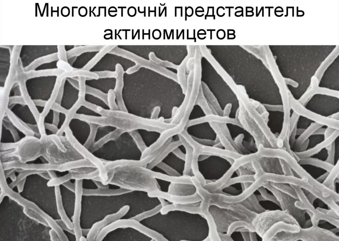 «Разлагая органику, сапрофиты не просто сменяют друг дружку, но и располагаются послойно: чем глубже слой, тем труднее переваривать его остатки. Едоки строго распределили зоны кормёжки, и каждый знает свою часть работы. А корни знают структуру едоков. Вот откуда столько неувязок, когда органику закапывают или запахивают. И так мало пользы, когда её компостируют в кучах» Н.Курдюмов