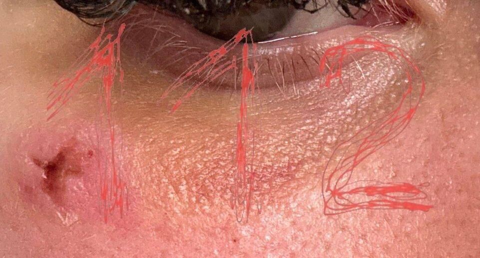    Telegram-канал 112