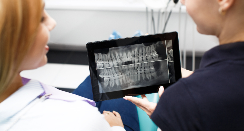 Зубы из «ничего»: Почему в 2026 году наращивание кости — это прошлый век (почти)