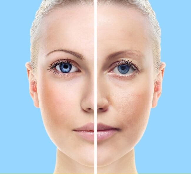 источник фото - pinterest.com