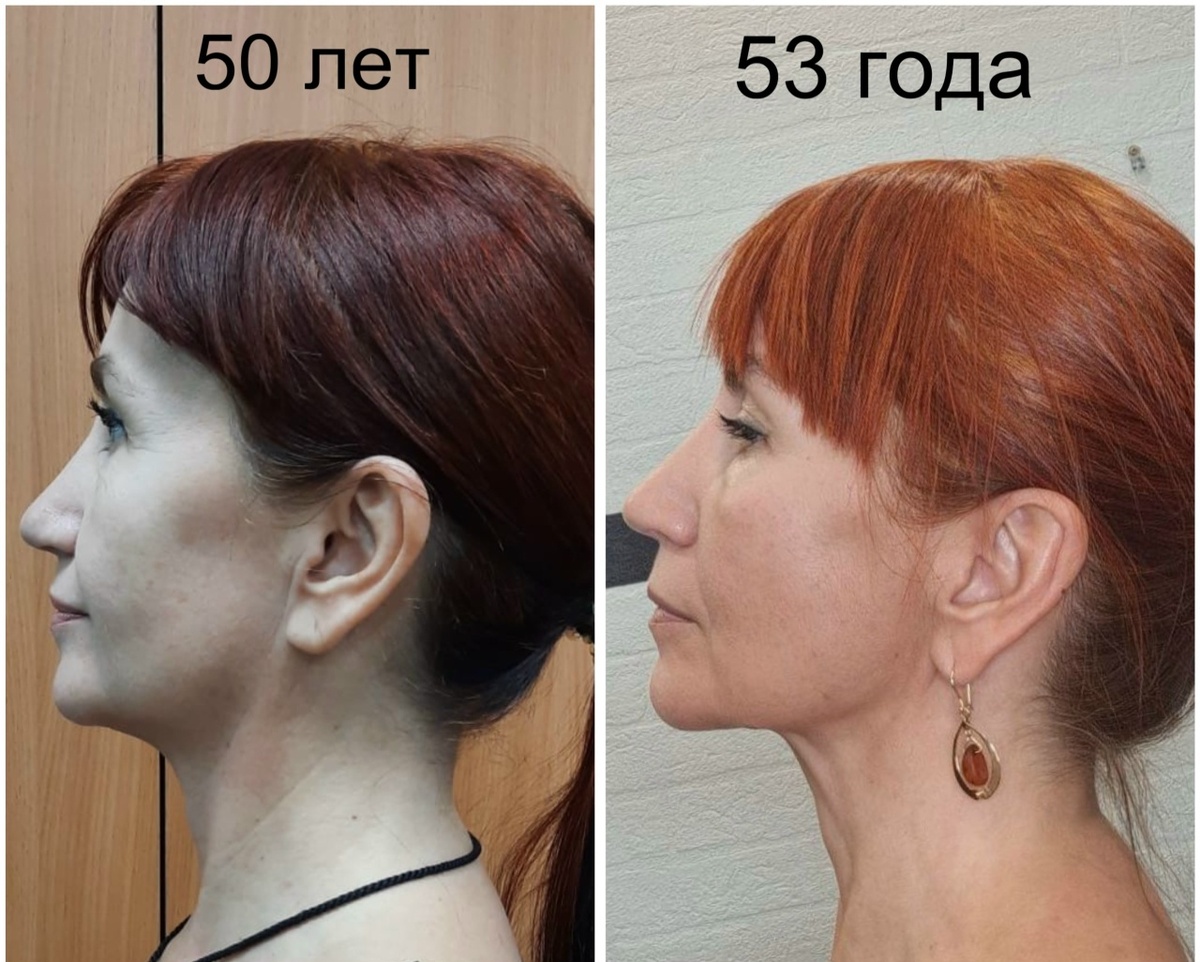 Результат моих клиентов до/после