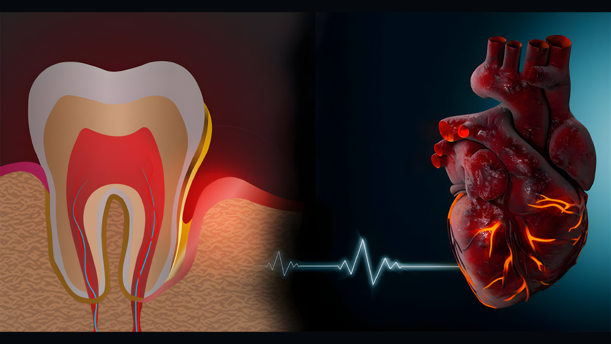 Связь здоровья зубов и сердца: анатомический разрез зуба с воспалённой десной и модель сердца, соединённые линией кардиограммы. Воспаление в полости рта напрямую влияет на сердечно-сосудистую систему — это доказанный медицинский факт.