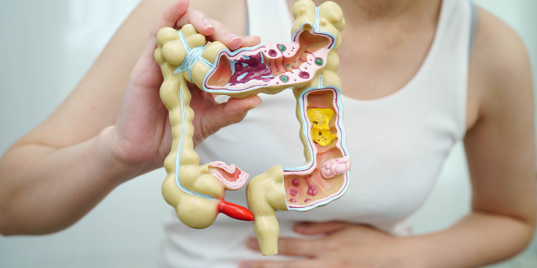 Первые признаки рака кишечника: как не пропустить болезнь