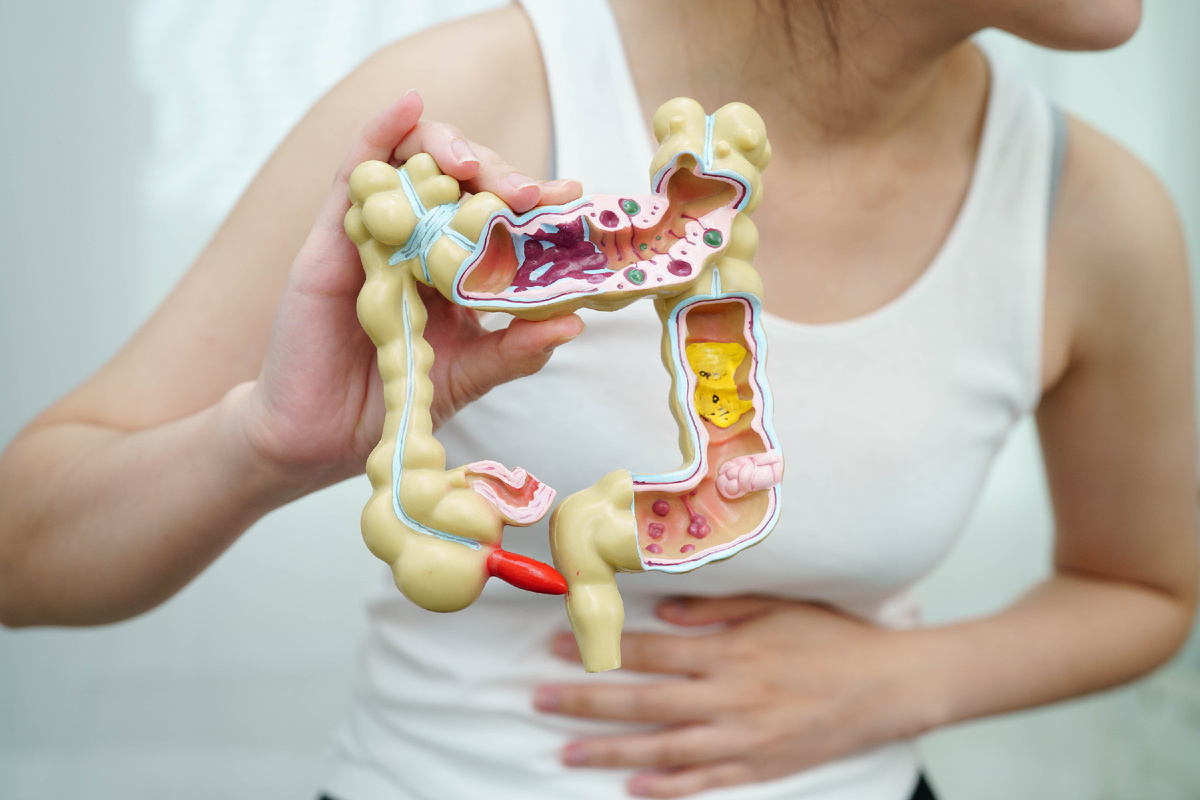 Рак кишечника можно выявить задолго до появления явных симптомов