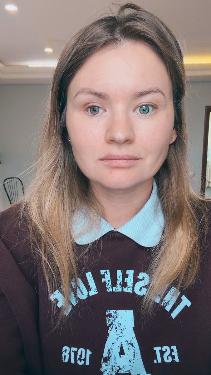 Герпес прошел, след остался, вылез прыщ)))