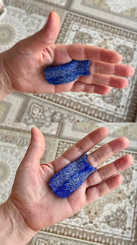 Ортез при болезни Нотта