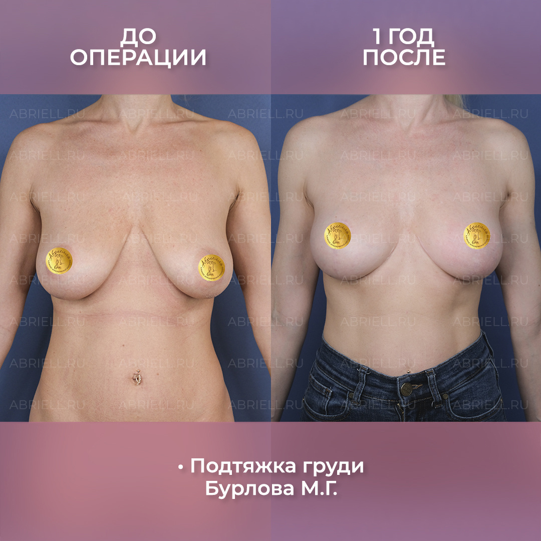 Бурлома Мария Григорьевна Пластический хирург в Санкт-Петербурге клиника Абриелль