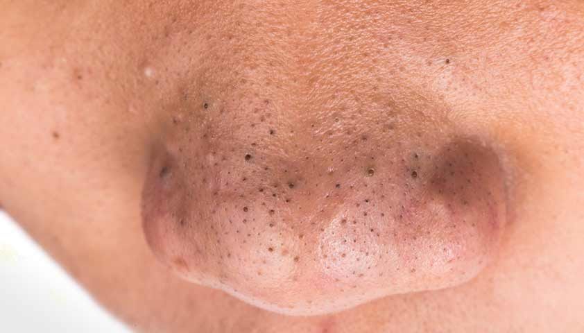 Черные точки