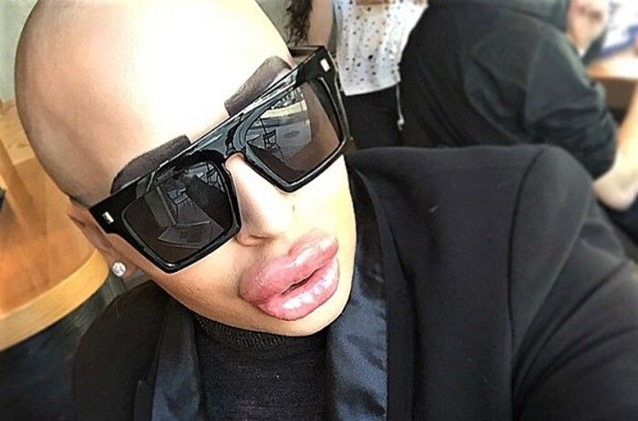     / Источник: Социальные сети