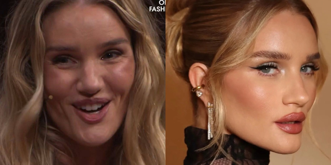 Что происходит с лицом красотки Рози Хантингтон-Уайтли (38 лет)?