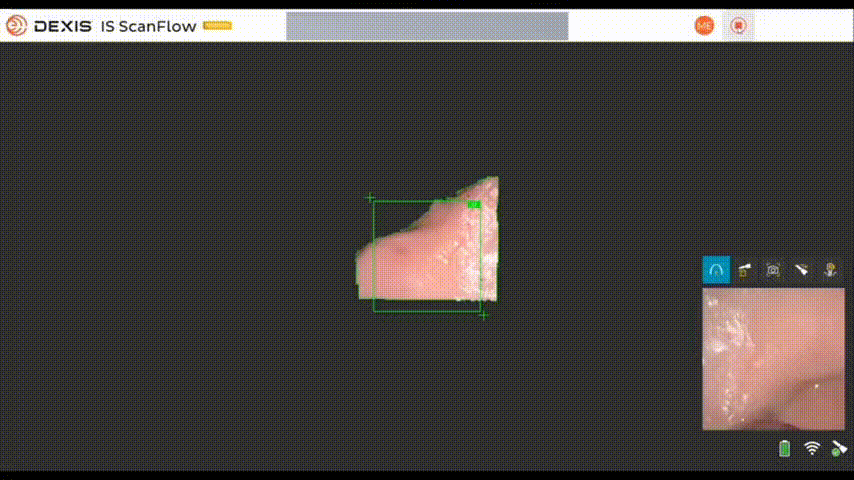 Верхняя челюсть