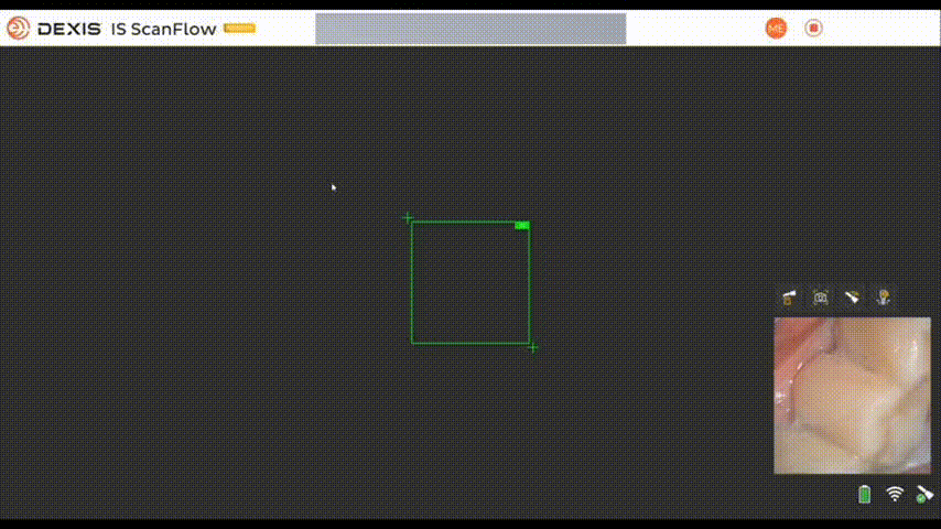 Нижняя челюсть
