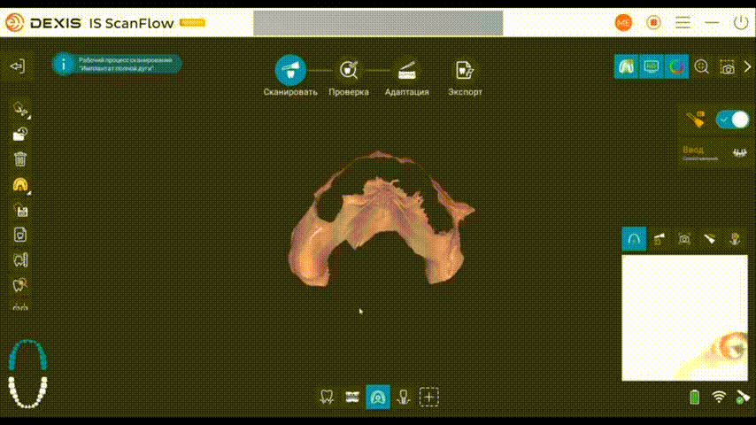 Верхняя челюсть