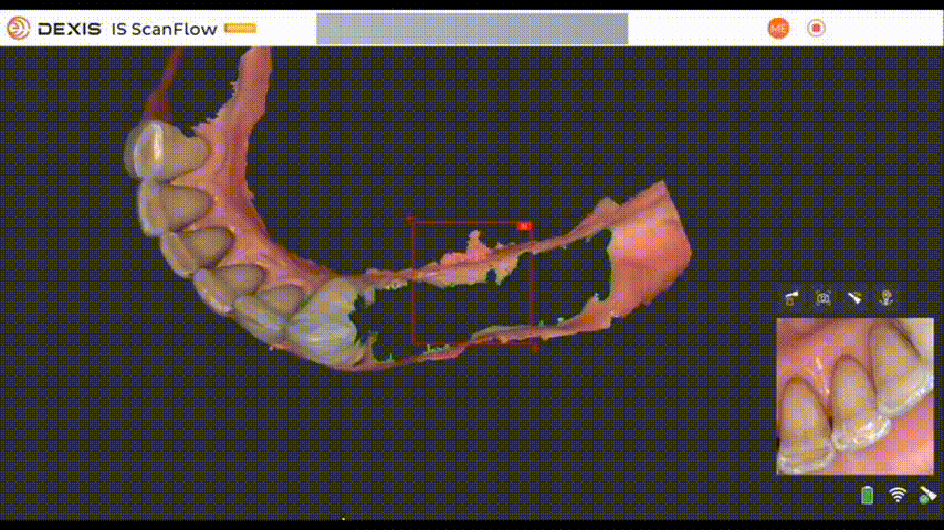 Нижняя челюсть
