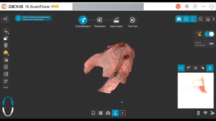 Верхняя челюсть