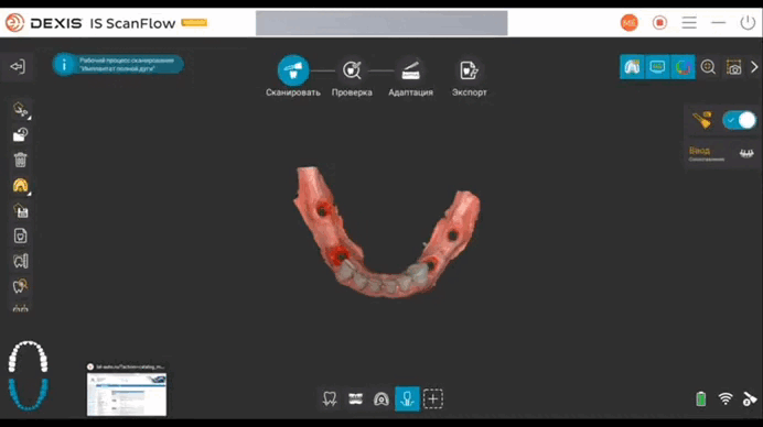 Нижняя челюсть