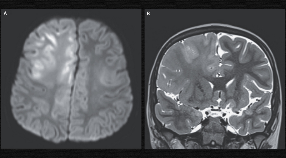   Michael S. Kung, John Ross Crawford / NEJM, 2026