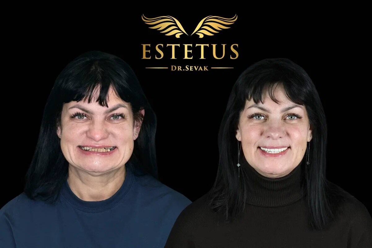 Ольга Анатольевна, г. Москва, клиника доктора Севака Estetus