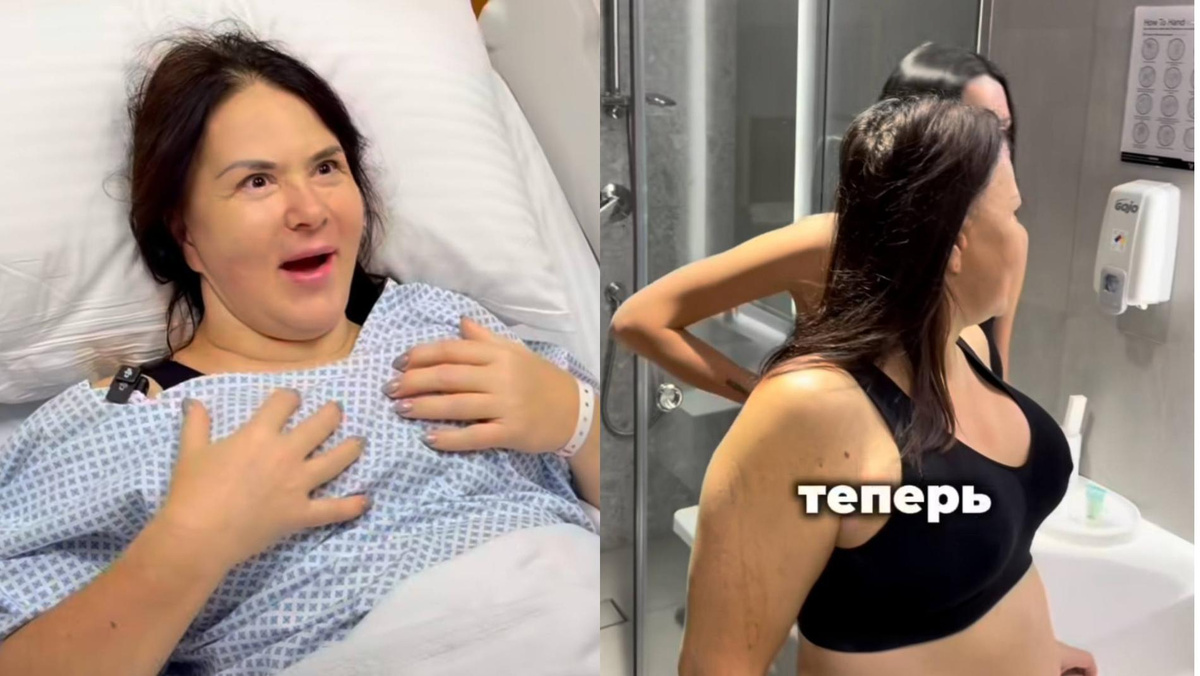    Мама Оксаны Самойловой после операции. Скриншот: Инстаграм (запрещён в РФ) @samoylovaoxana