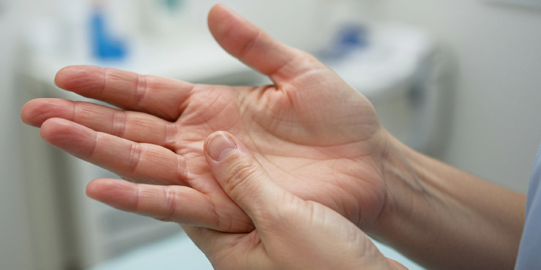 Онемение рук: Сигналы, которые подает тело, и на что обратить внимание