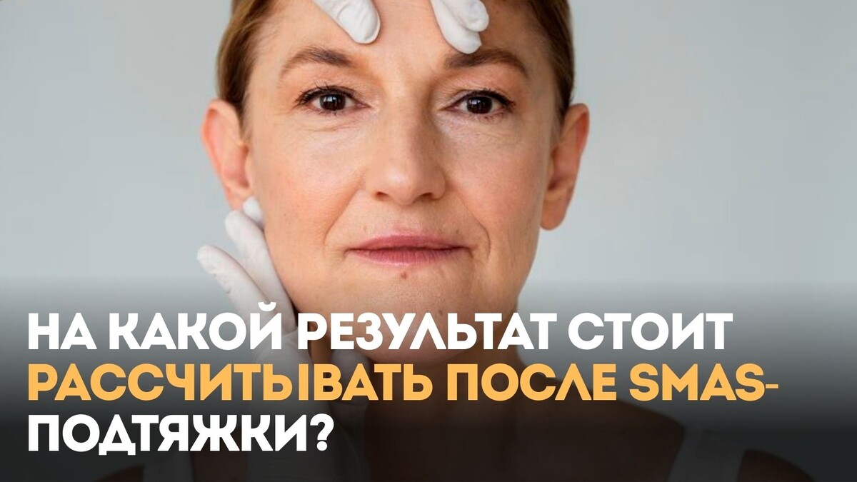 На какой результат стоит рассчитывать после SMAS-подтяжки