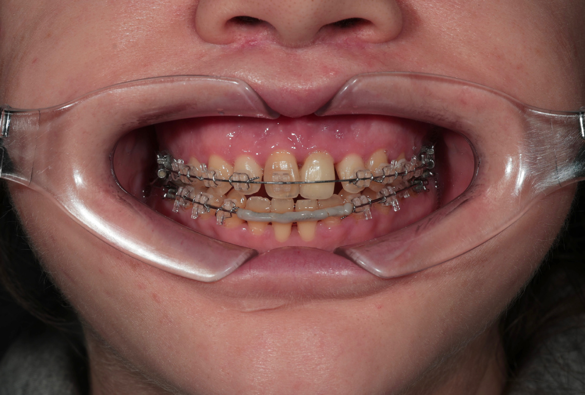 Состояние, с которым к нам обратилась пациентка