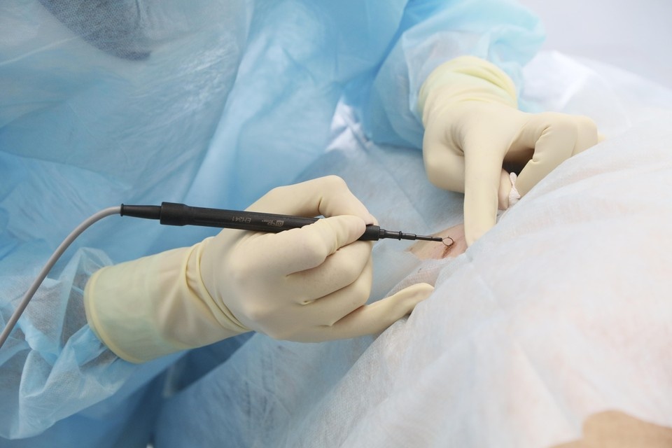    В Канаде у женщины выявили неожиданный симптом после операции: говорит с русским акцентом Иван МАКЕЕВ