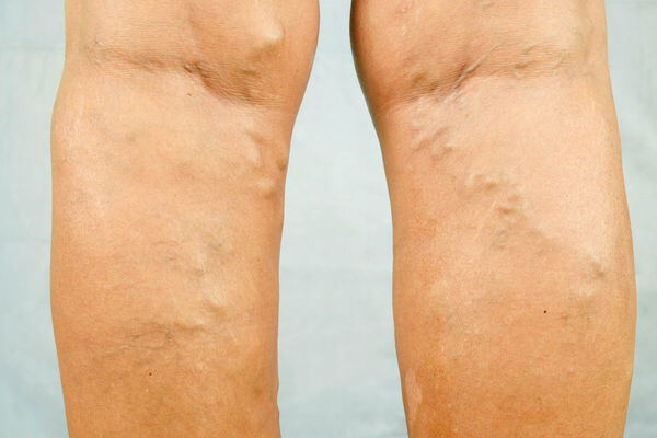 David Parry/Global Look Press   📷