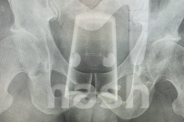 Telegram-канал Mash  📷