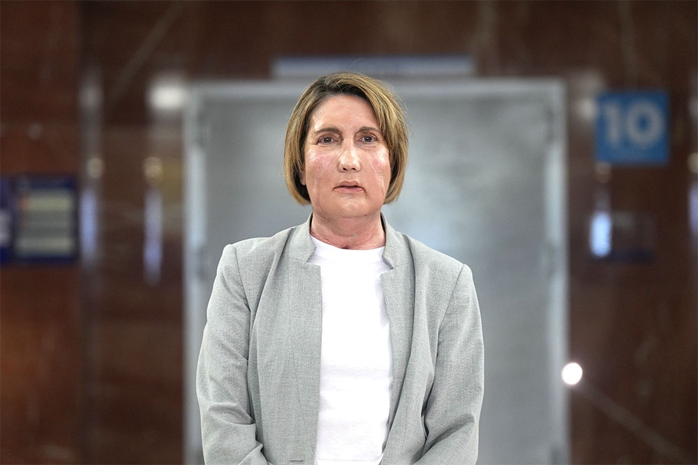    Пациентка с новым лицом заново учится улыбаться и говорить. / Фото: Zuma / ТАСС