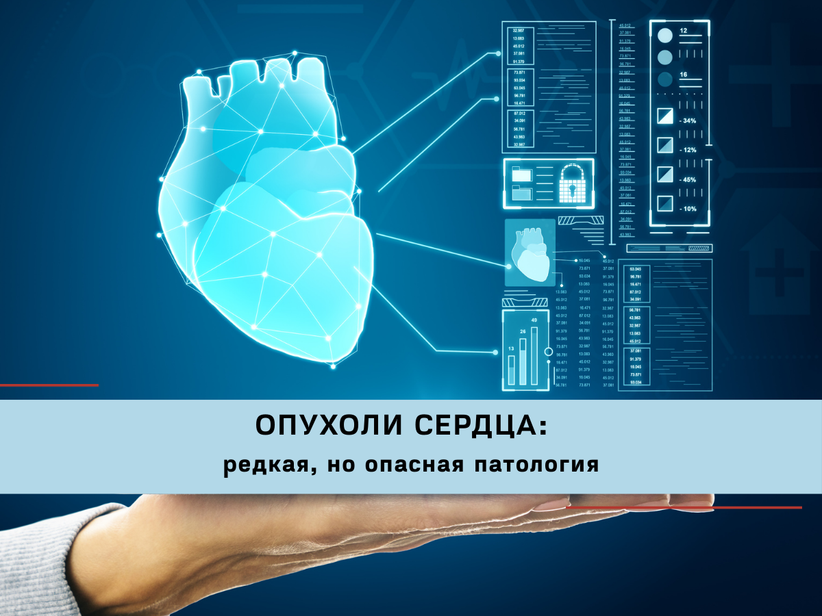 Из-за редкости опухолей сердца их диагностика и лечение требуют опыта специализированных кардиохирургических центров.