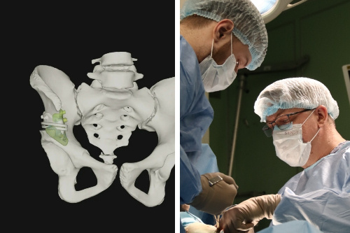    Фото: Новосибирский НИИТО им. Я.Л. Цивьяна