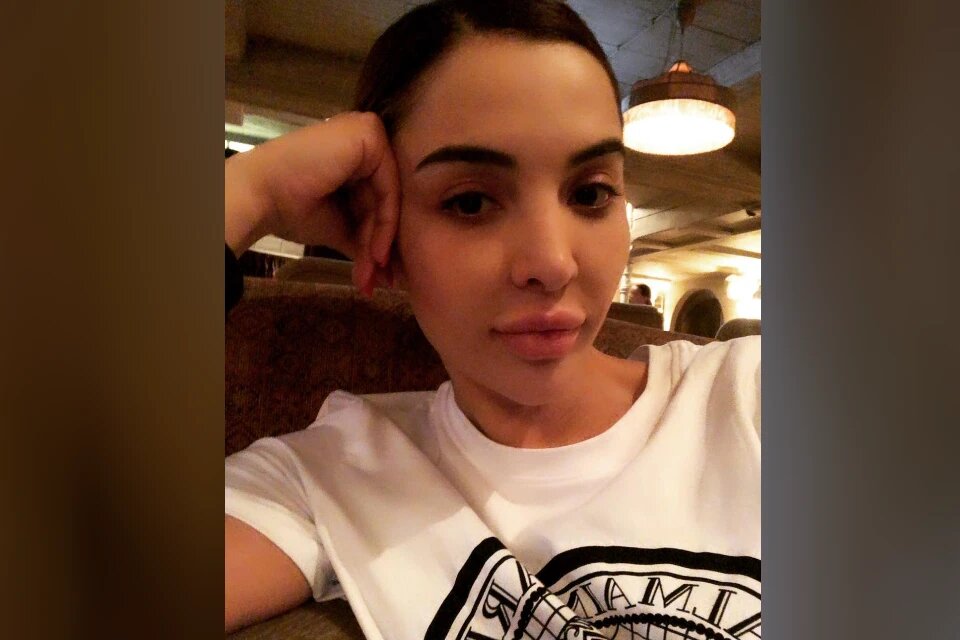 Мадина Байрамукова известна как Доктор Ботокс. Фото: соцсети