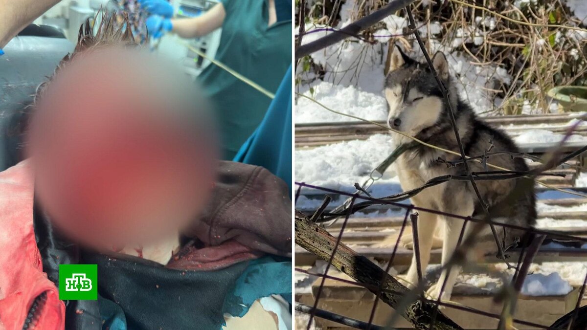    Без еды и воды: съевшие лицо ребенка в Сочи хаски жили в невыносимых условиях