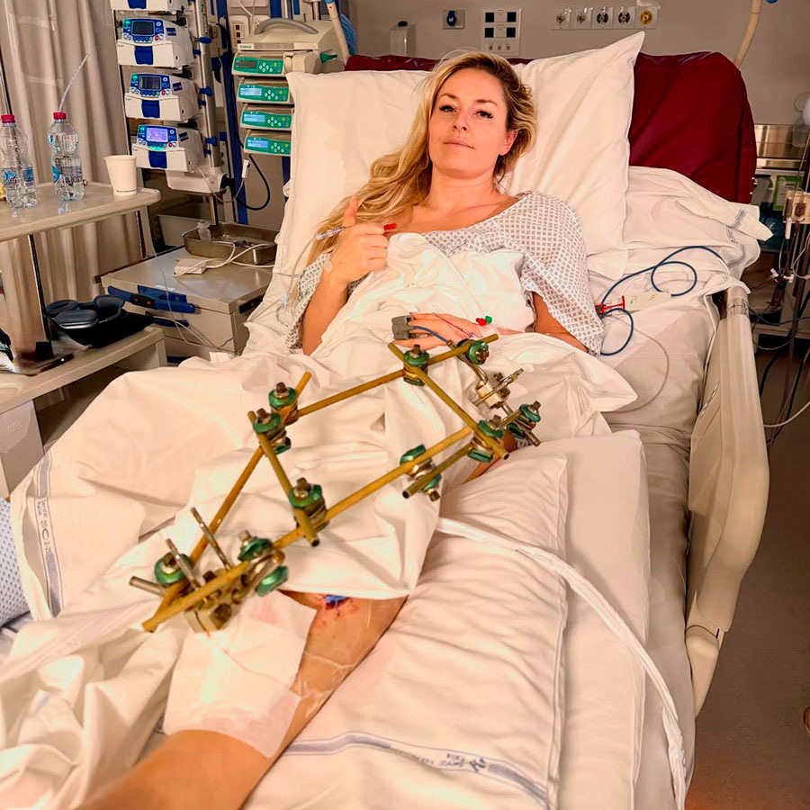 Американка пояснила, что когда в одной части тела случается обширная травма, то там скапливается слишком много крови, в результате чего она застаивается. По сути, перестают работать мышцы, нервы. Все начинает отмирать.📷    Фото: lindseyvonn / Instagram
