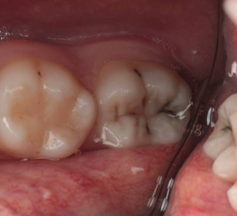 На фото 6 и 7 - 8 даже не видно