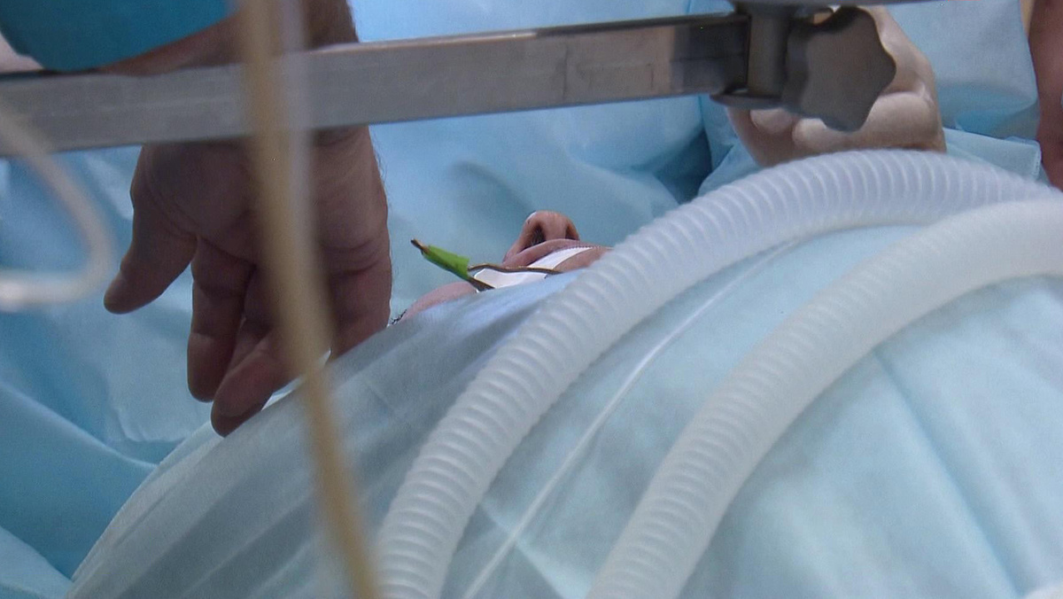    HD Пластическая операция хирург