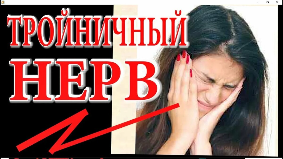 Невропатия Тройничного нерва.