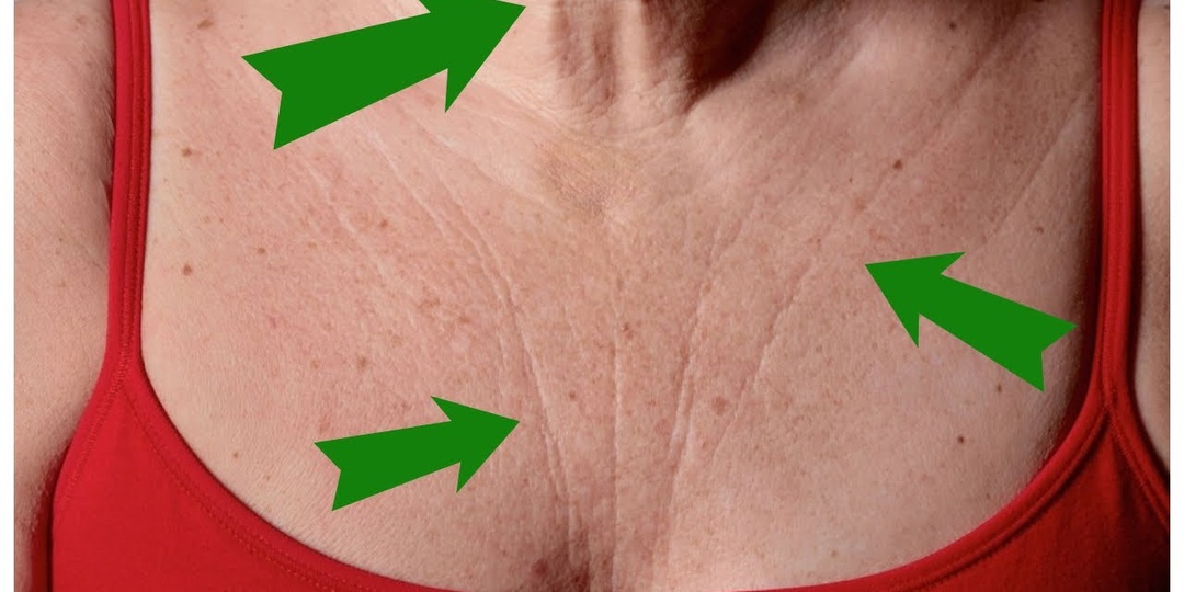 7 изменений кожи после 55, которые могут говорить о внутренних рисках