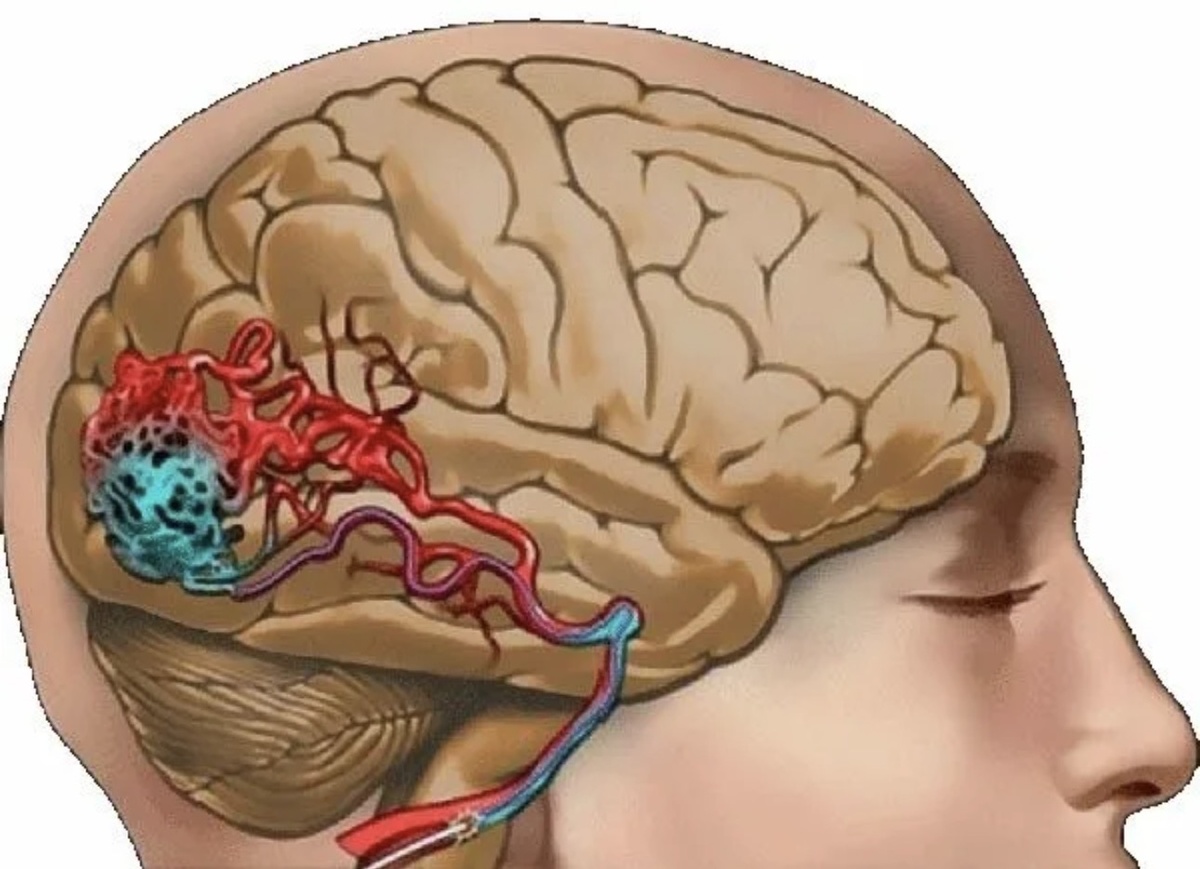 Строение сосудистого русла схематично изображено на картинке.