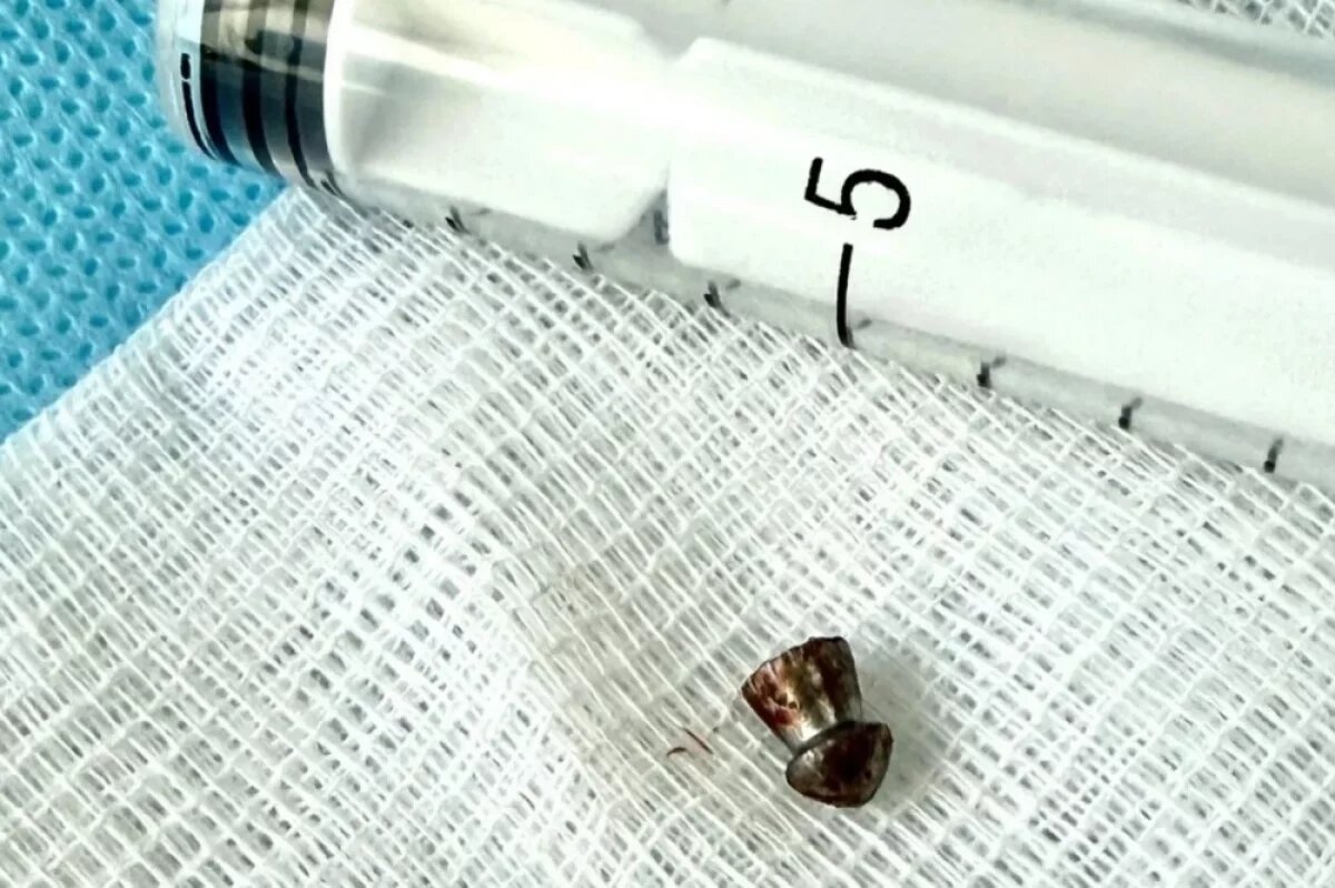    Врачи во Владивостоке извлекли пулю из лица 12-летнего мальчика